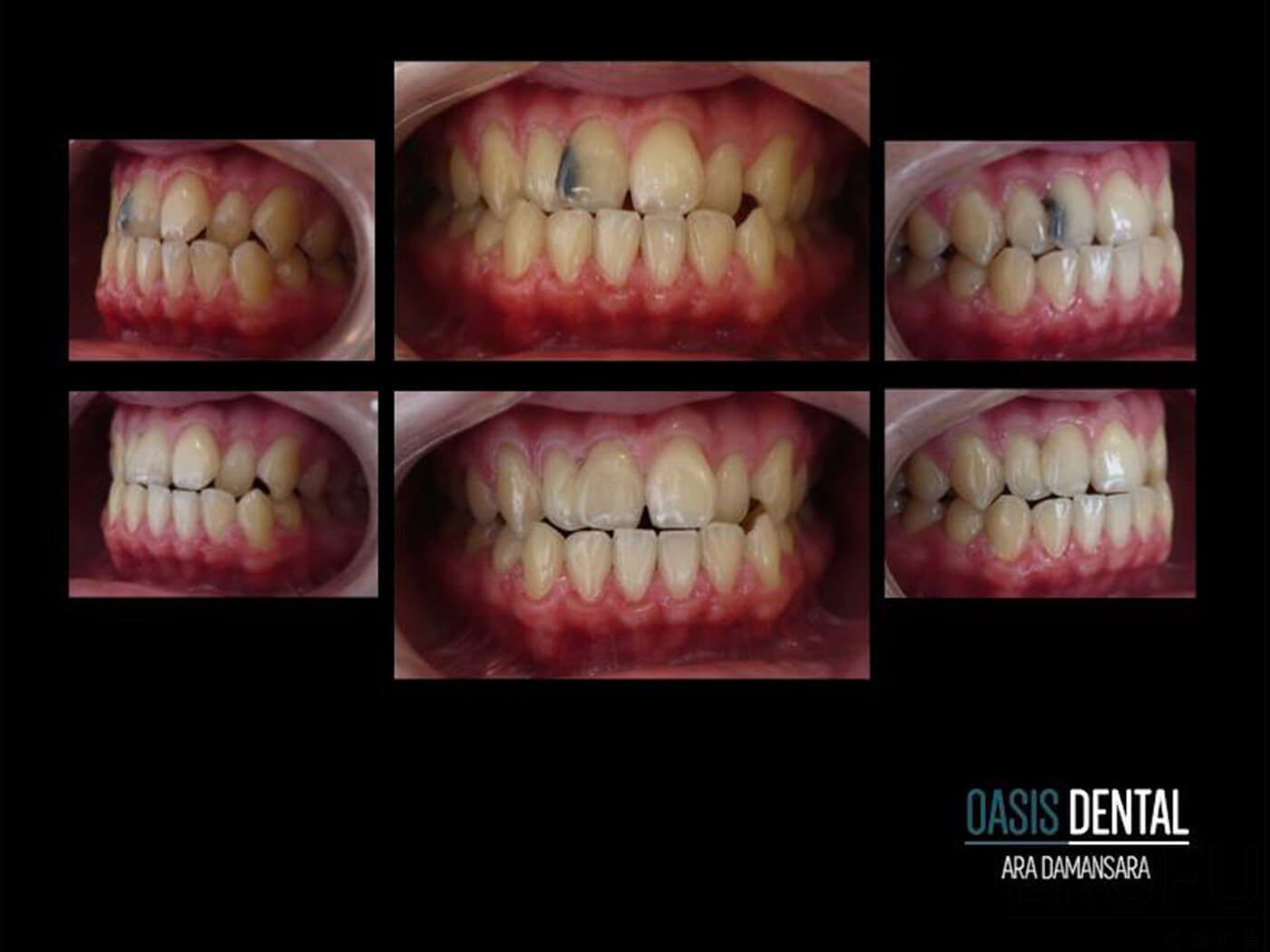 Pergigian Oasis @ Ara Damansara