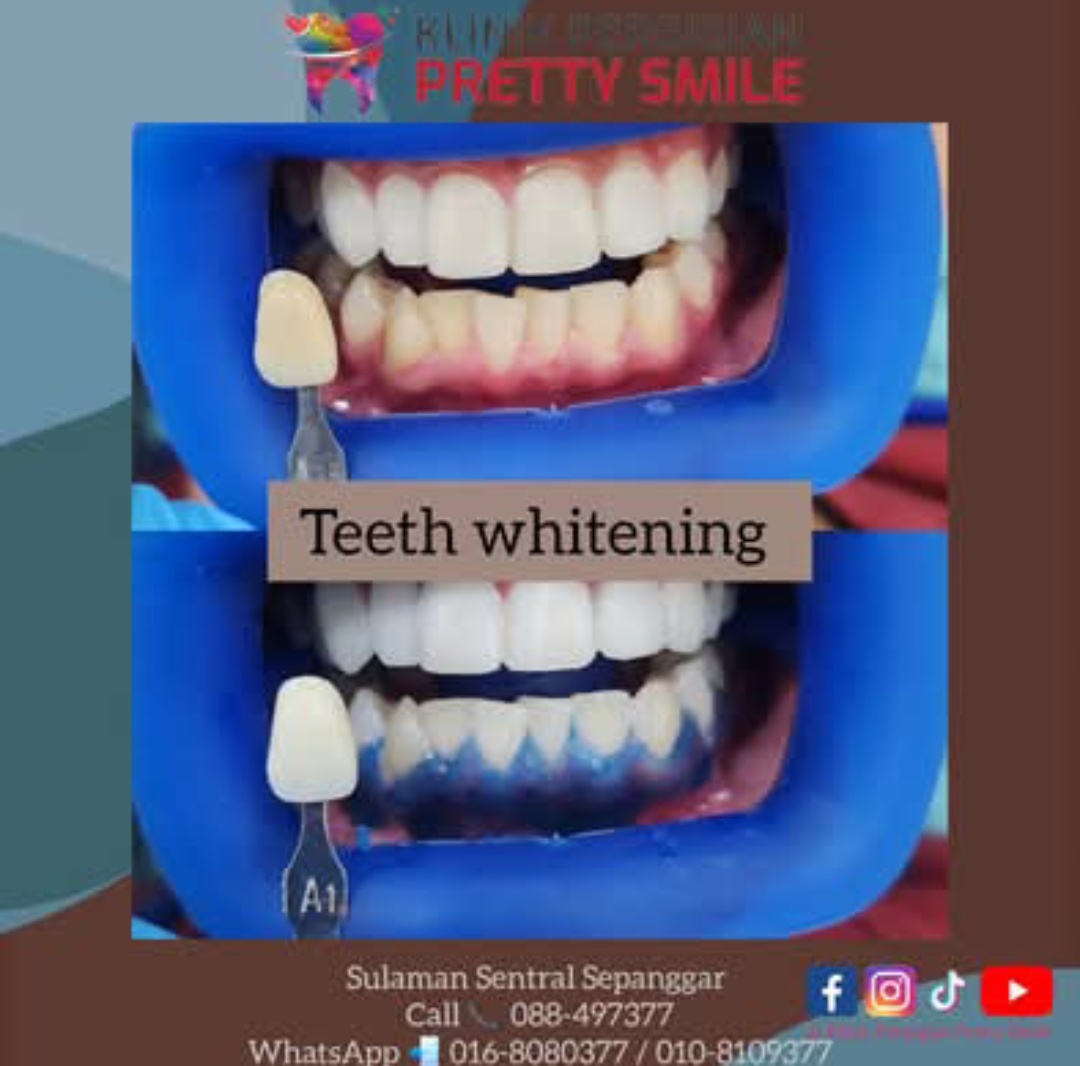 Klinik pergigian pretty smile